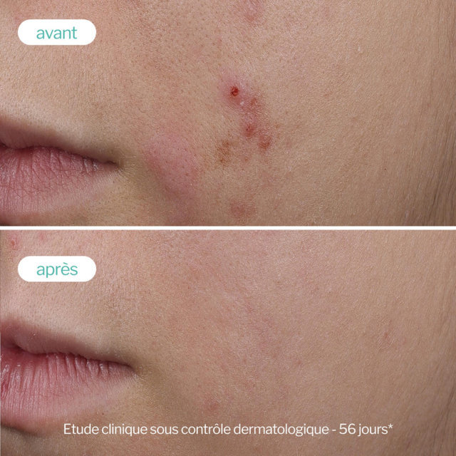 Siero Booster allo Zinco Anti Imperfezioni Novexpert