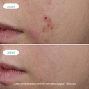 Siero Booster allo Zinco Anti Imperfezioni Novexpert