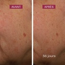 Siero Anti Macchie Azione Anti Ricomparsa